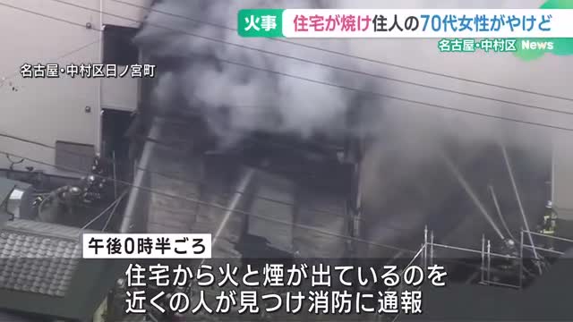 名古屋市中村区の住宅で火災、70代女性がやけどで搬送