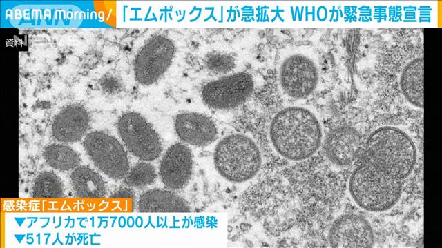 「エムポックス」急拡大でWHO緊急事態宣言 アフリカ中部などで今年1万7千人以上が感染