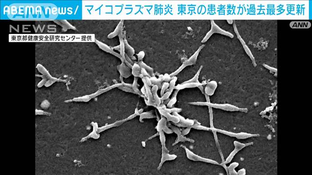 【速報】東京都のマイコプラズマ肺炎の患者数「2.96人」　2週連続で過去最多を更新