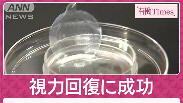 世界初“iPS角膜シート”で変わる未来　重い「心不全」治療へ“心筋球”の可能性