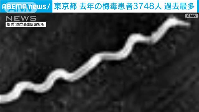 【速報】東京都の去年の「梅毒」患者数が過去最多の3748人に　3年連続で3000人超